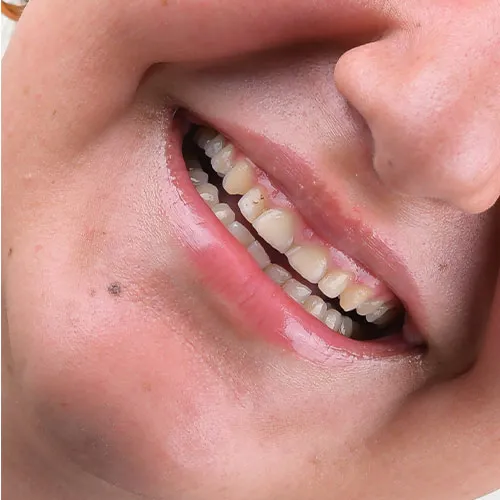 الدکتوره سمانه عارفی فی ایران (1)