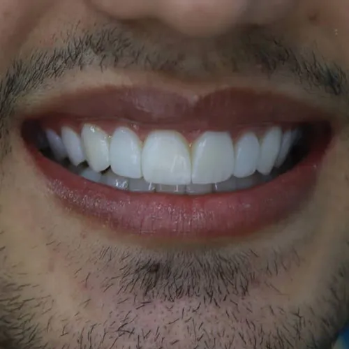 الدکتوره زینب وجوی یکتا تجميل الاسنان فی ایران ایلام طب 1 صور 1