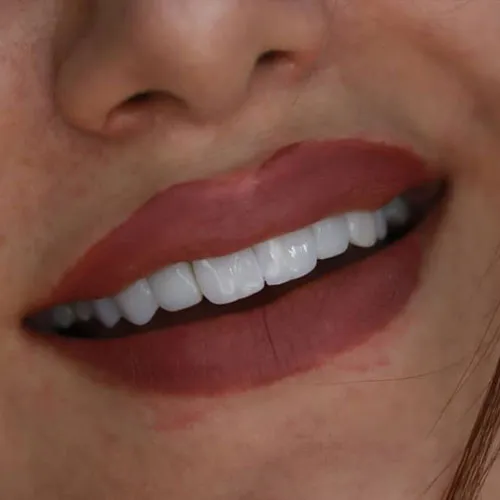 الدکتوره زینب وجوی یکتا تجميل الاسنان فی ایران ایلام طب صور 3