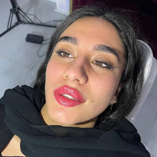 الدكتورة زهرة مومنی، الدکتور امامی نیا التجميل بدون جراحة 3