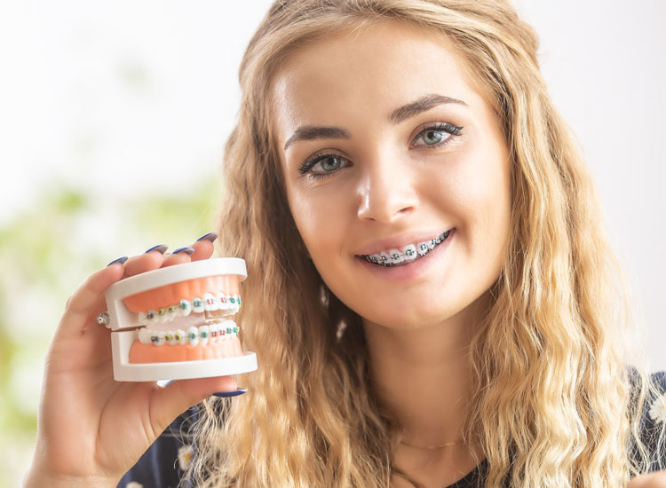 ابتسامة أكثر جمالًا وثقة مع تقويم الأسنان 2