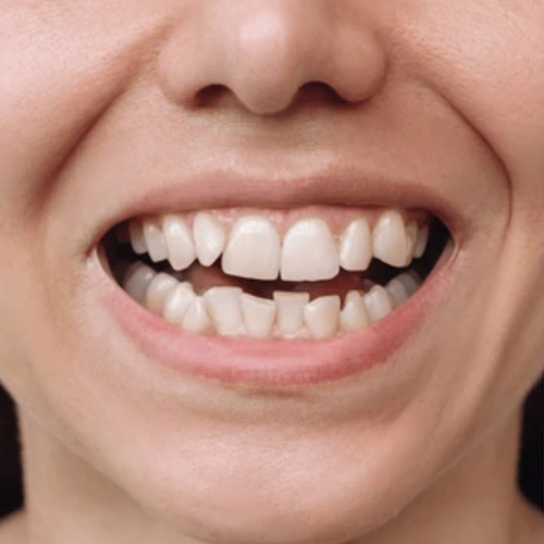 صور القبل 1 الدکتوره شهین بهمنی